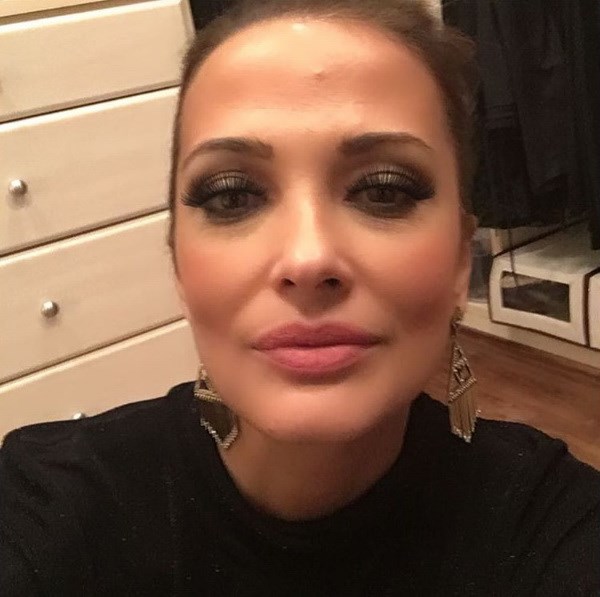 Η selfie της Αλέκας Καμηλά που δείχνει την ατέλεια του προσώπου της